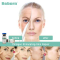 Mesotherapy Injection Hydrogel Filler