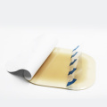 Hydrocolloid Bandage Wound Dressing