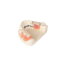 Removable Denture Metal Partial Vatalium Frame