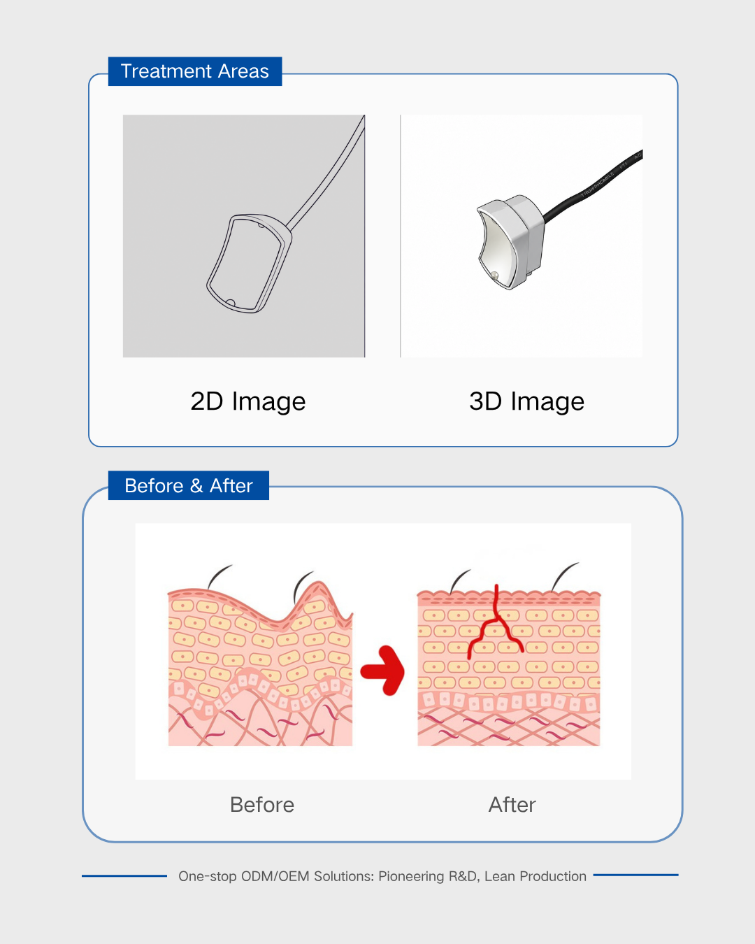 เครื่องอัลตราซาวนด์ที่เน้นพลังงานสูง 4MHz 4MHz High-Energy Focused Ultrasound Transduce