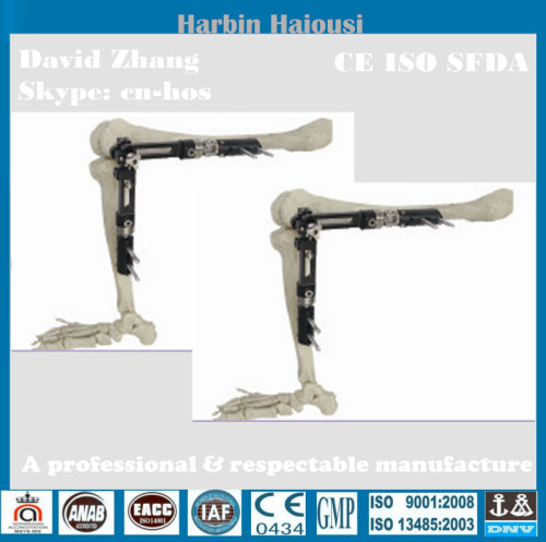 orthopedics implants surgery instruments articulatio genus External Fixator