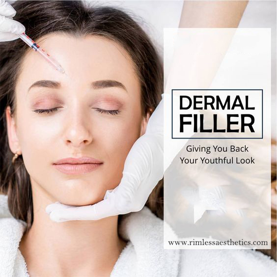 what are dermal filler