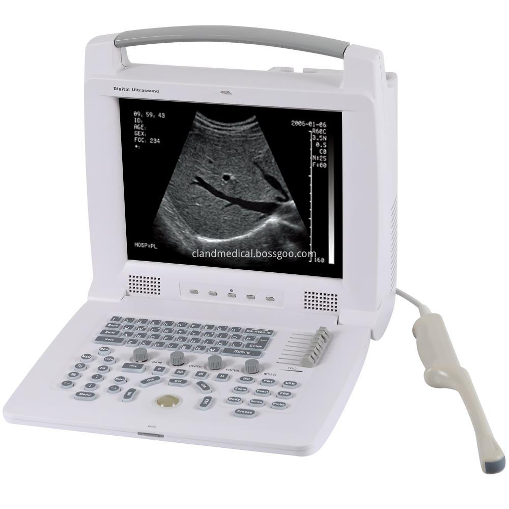 Pl 3018i escáner de ultrasonido portátil digital completo 11 Pl 3018i Full Digital Portable Ultrasound Scanner 11