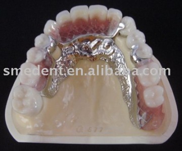 Dental magnetic attachment/MK1 attachment