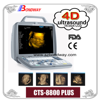 4D ultrasound imaging system