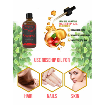 मालिश Aromatherapy OEM के लिए कार्बनिक गुलाब का तेल का स्वागत किया