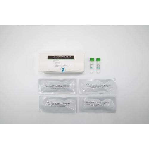 Ev71 Nucleic Acid Test Kit (PCR- fluorescence probe method)