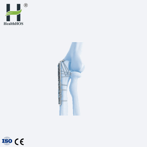 Ulnar proksimal VA-LCP Plat Olecranon