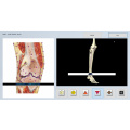 perangkat diagnostik aura non-linear oberon