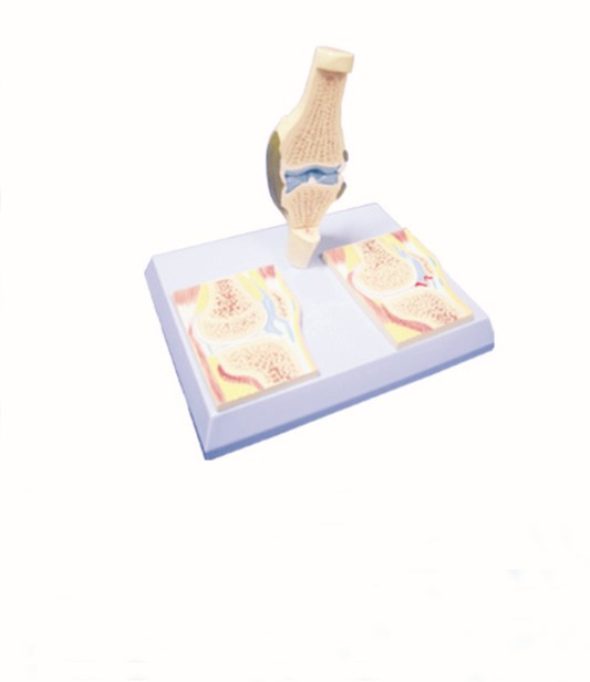 Artificial Knee Joint Model With Muscles And Ligaments, High Quality ...