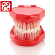 Transparent Gum Model with Removable Teeth