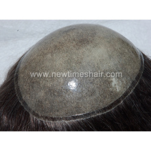 Injected silicon skin toupee hair replacement system