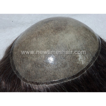 Injected silicon skin toupee hair replacement system