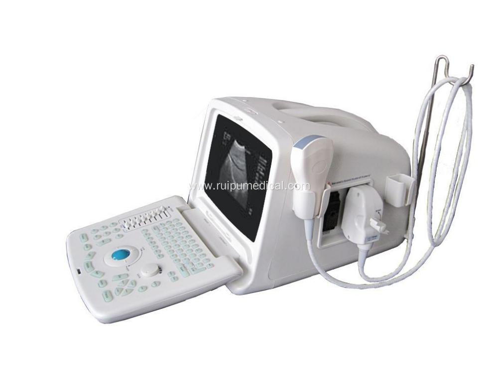 Price Ultrasound Machine Digital Ultrasound Scanner Portable