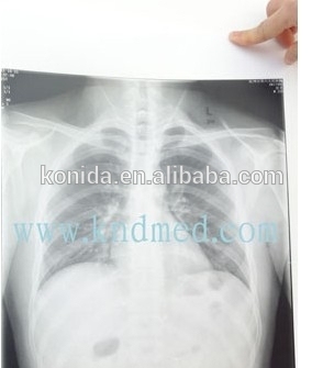 cr scanner films digitizer x-ray digital film x ray film ct dr