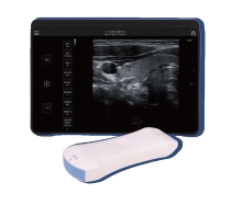 Handheld Ultrasound Scanner with Tablet Display