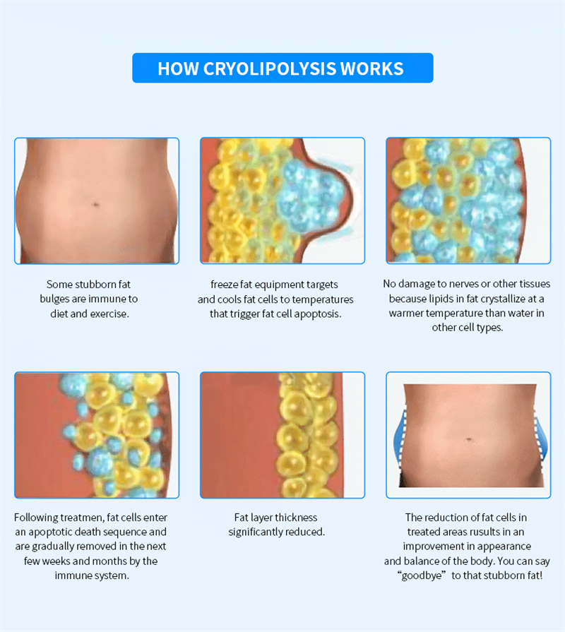 Cryo 3 Cryo 3
