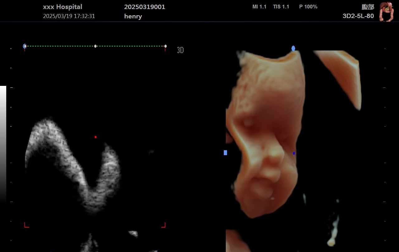 Krayson Portable Color Doppler Ultrasy з 4D Krayson Portable Color doppler ultrasound with 4D