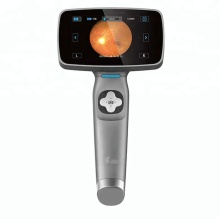 China's Latest Portable Fundus Camera for Eye Exams