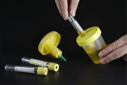 PP Material Disposable Sterile Urine Container With Needle