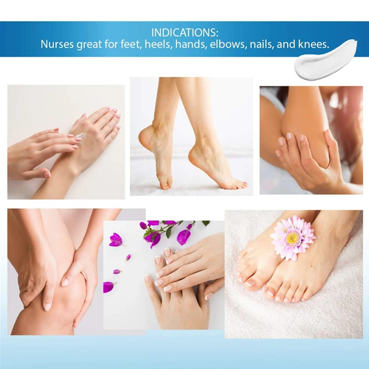 Natural Moisturizing Skin Nourishing Urea 40% Foot Cream