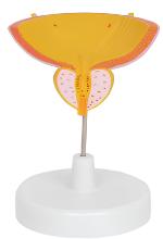 Male model of bladder and prostate prostatectomy