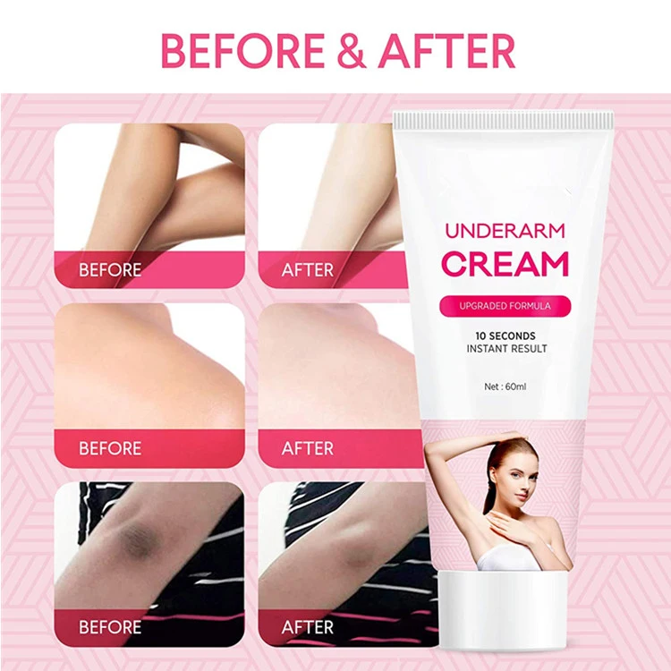 Hot Selling Dark Spot Corrector Cream for Armpit, Knees, Elbows, Private Areas