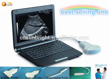 portable/plam/ laptop cheapest ultrasound / ultrasound system