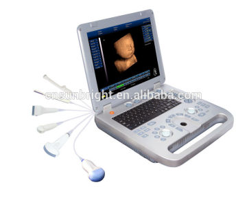 cardiac color ultrasound scanner