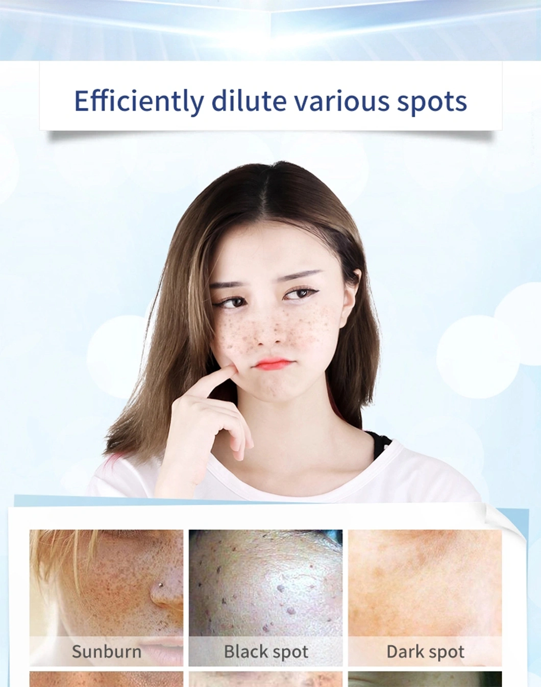 Professional Skin Care Anti Freckle Face Cream