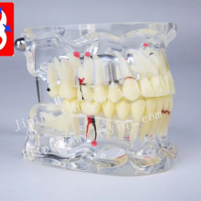 Adult Pathological Dental Model with Dental Issues
