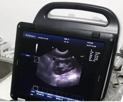 Veterinary Sonography System Es250V