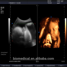 CE Hospital Cardiac Fuction Portable 3D 4D Colour Doppler Ultrasound Price