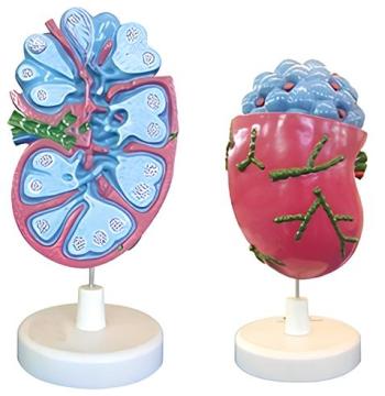 Lymph Node Magnification Model