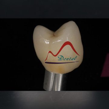 Dental zirconia implant crown