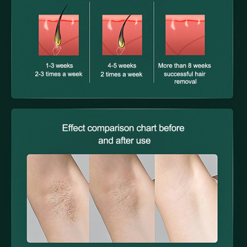 ICE Hair Removal 2021 Sản phẩm Hot hiện đại