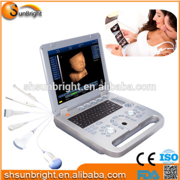 Ultrasound machine color ultrasound/4D ultrasound machine