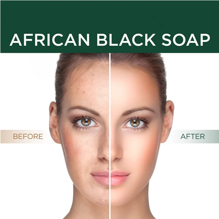 100% Organic Raw African Black Soap for Detoxifying & Anti-Aging