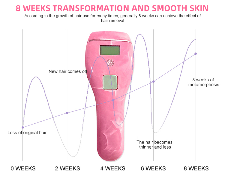 Máquina de remoção de cabelo a laser de cinco engrenagens de cinco engrenagens