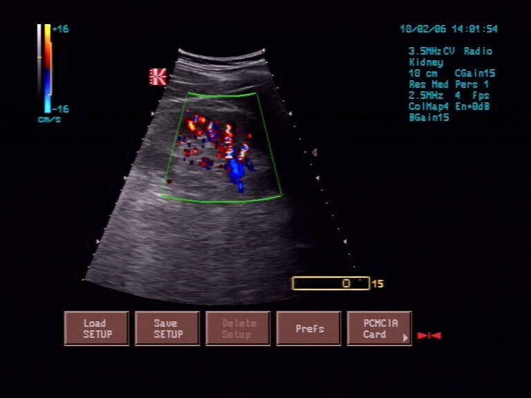 Color Doppler Ultrasound Diagnosis System (AM-380)