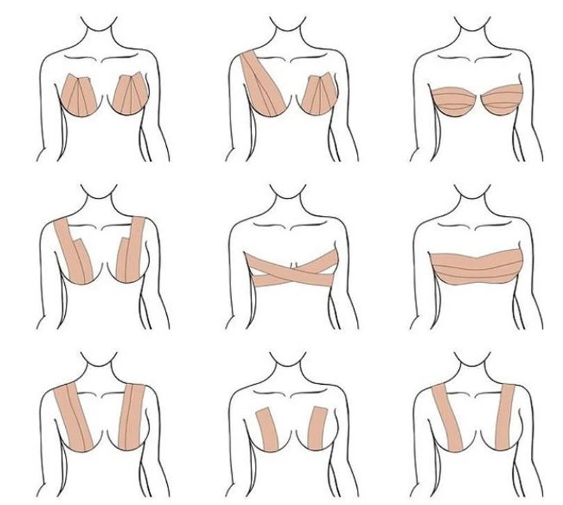 סרט להרמת חזה