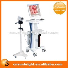 high quality colposcope digital imaging system with CCD camera