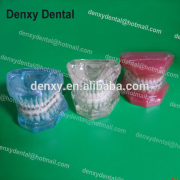 Promotional top quality dental orthodontic dental model / orthodontic plastic model