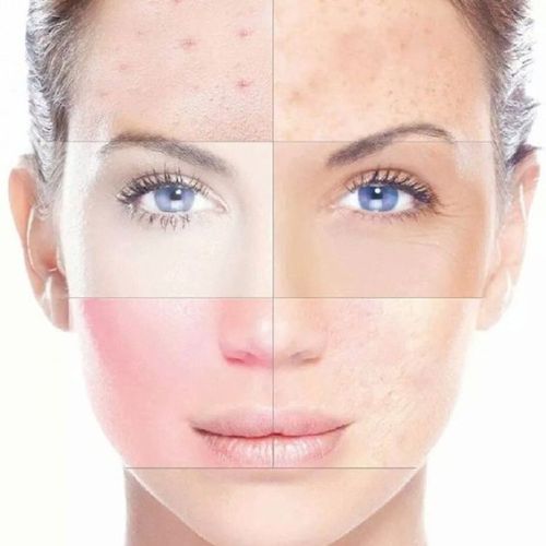 Cosmetics Clinic Use Dermal Fillers