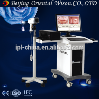 Gynecology examination medical colposcope digital gynecological examination equipment