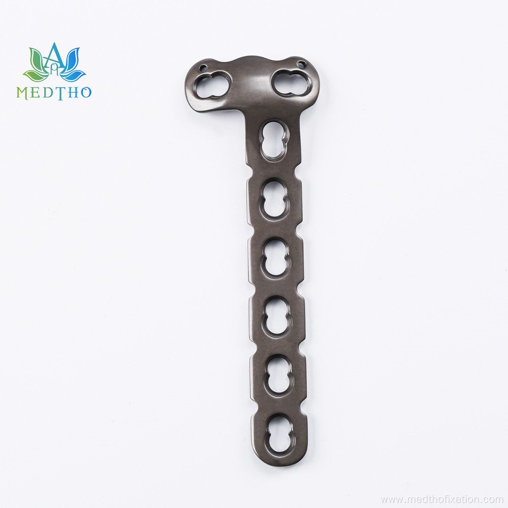 proximal lateral tibia locking plate