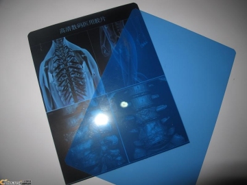 konida X-ray film Dry film Laser Imaging Film