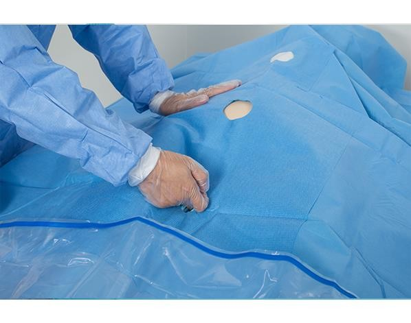 Disposable Non-woven Surgery Angiography Pack Surgical Drape