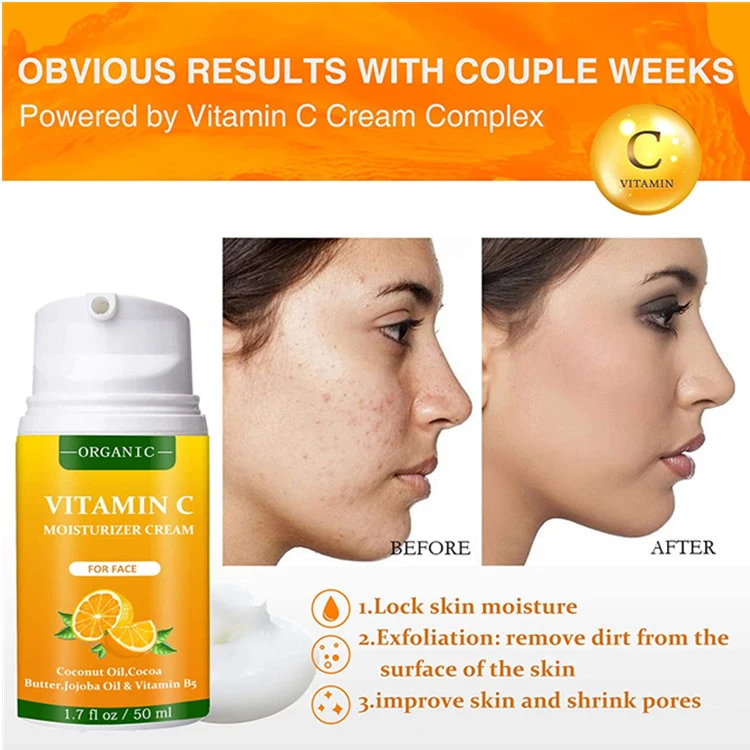 Organic Anti Acne & Dark Spot Brightening Skin Vitamin C Face Moisturizer Cream