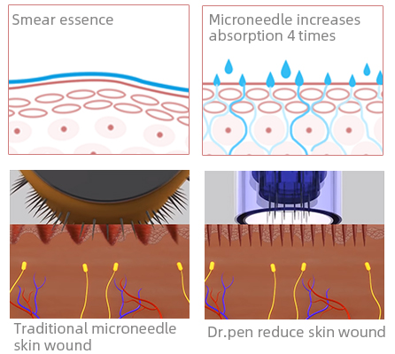 Reduce skin wound DR.pen M8 microneedles